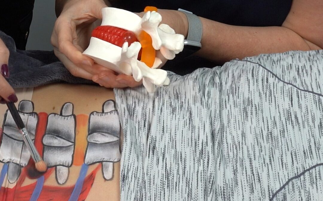 Sciatica Explained and Treatments (blog and video)